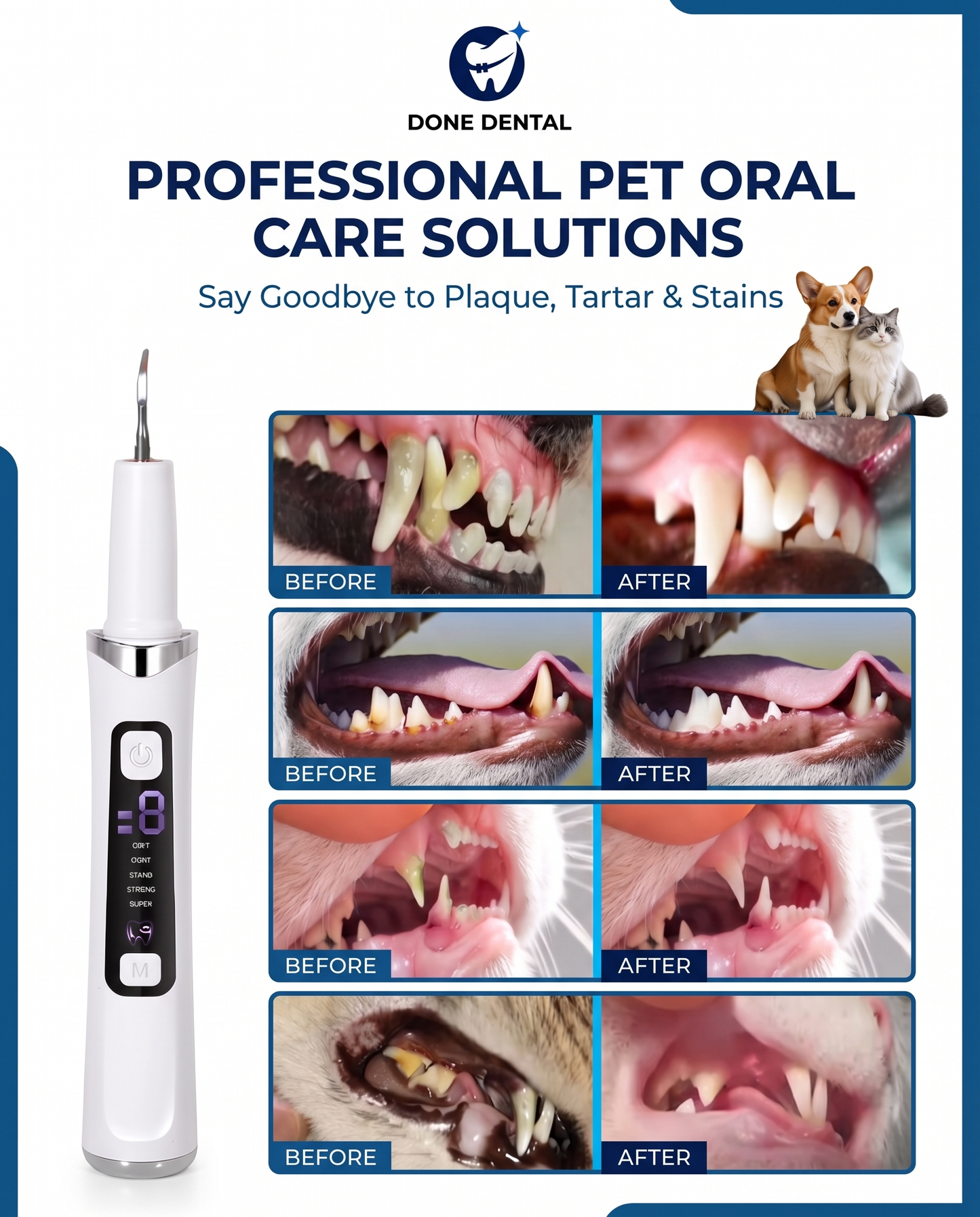 DONEDENTAL™ Plaque and tartar remover