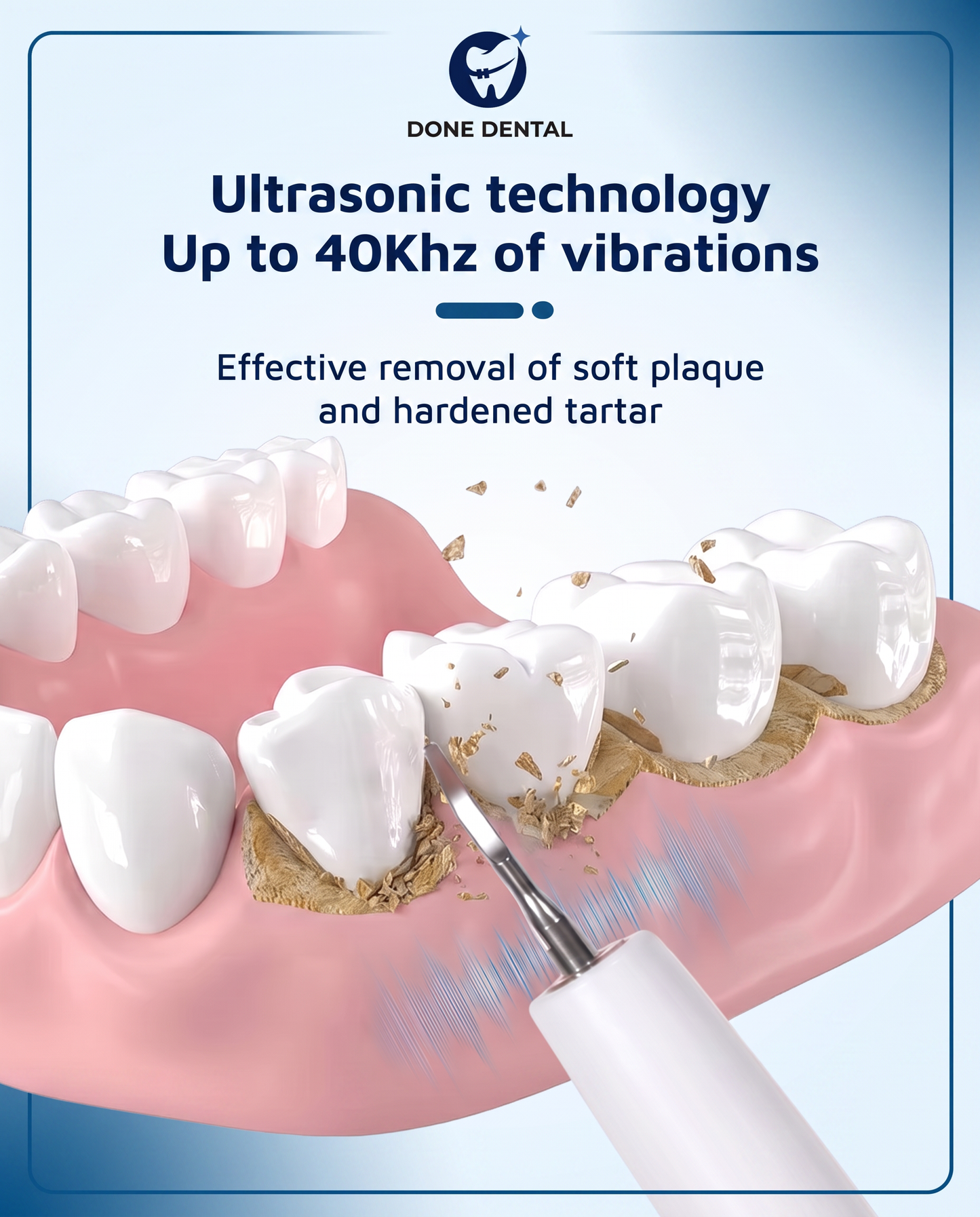 DONEDENTAL™ Plaque and tartar remover