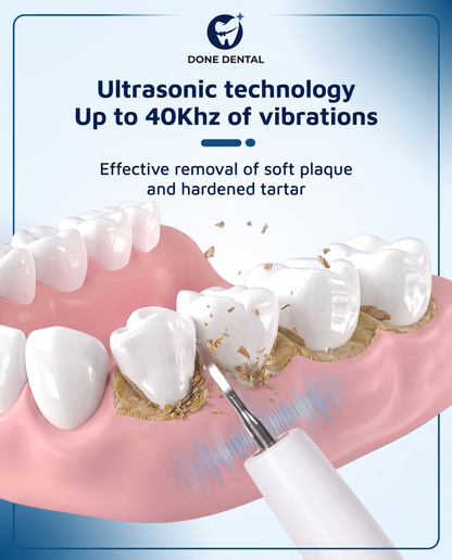 DONEDENTAL™ Plaque and tartar remover